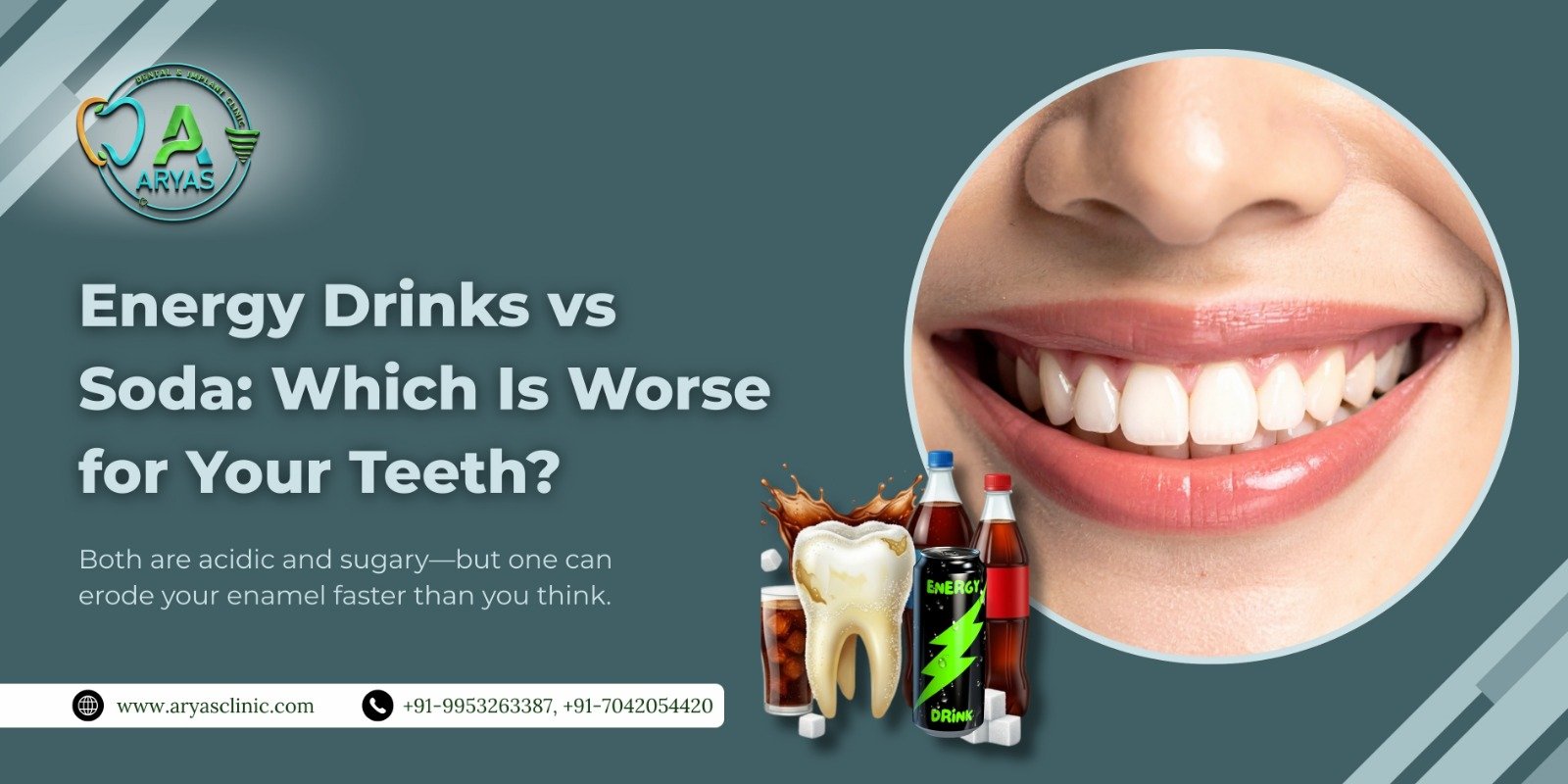  energy-drinks-vs-soda-teeth-damage-comparison-Aryas-Dental-best-dentist-Ghaziabad-Indirapuram